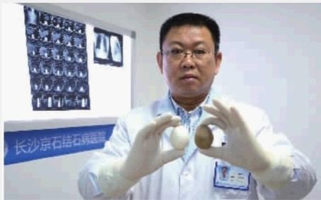 “天价宝”就是“动物结石”？湖南结石专家怒斥“天价羊宝”骗人